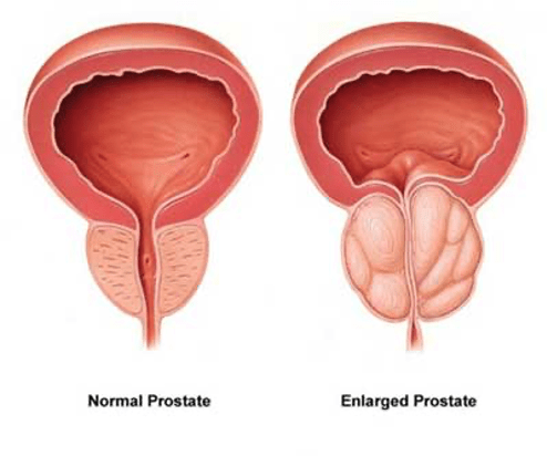 prostate massage healthy