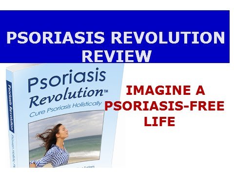 natural remedies for psoriasis treatment